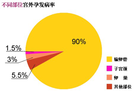 宫外孕发病类型