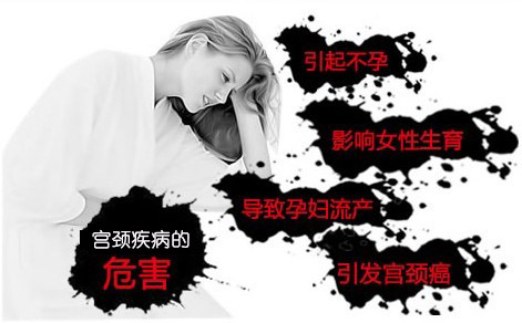 宫颈炎